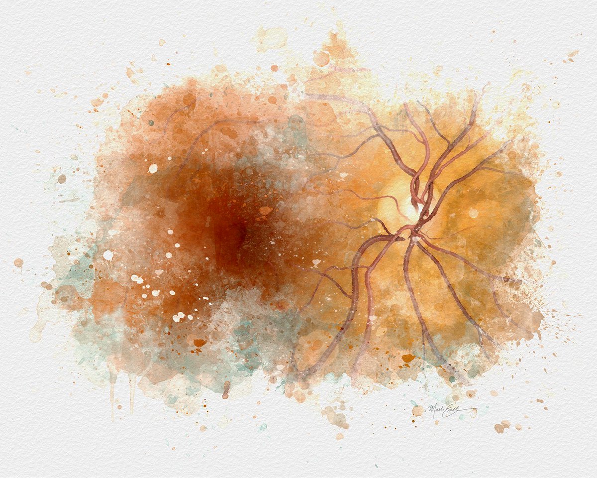 MedicalArtist's tweet photo. This print is on its way to its new home! Great eye doctor gifts! Get yours shipped tomorrow. Store link in bio.

#aao2021
#aao
#Ophthalmology
#eyeart
#ophthalmology
#ophthalmologist
#optometrist
#optometry
#eyedoctorgift
#retina
#eyesurgery
#medicalartist
#medicalillustration https://t.co/sOaAb4CY18