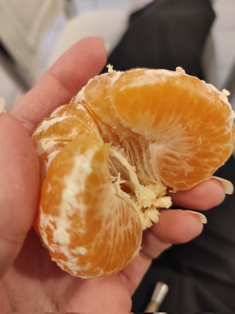 Babamı kaybedeli 2ay oldu nedense onun aldığı mandalinalar daha lezzetliydi şimdikilerin tadı yok gibi :(