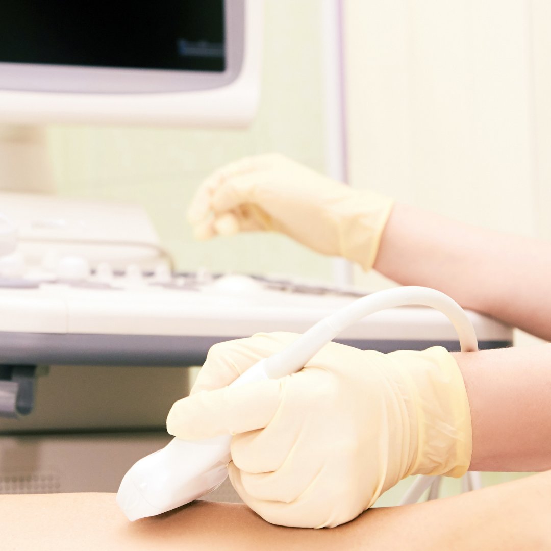 What to Expect During an Ultrasound

Learn more: 1l.ink/TKXPCZT

#TheUltrasoundCentre #Warman #Saskatoon #Rosthern #MedicalDiagnosticImagingCentre #MedicalImagingCentre #MedicalCentre #MedicalOffice #Ultrasound #LocalRadiologists