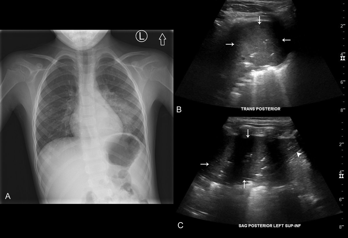 Thomas Marini tweet media