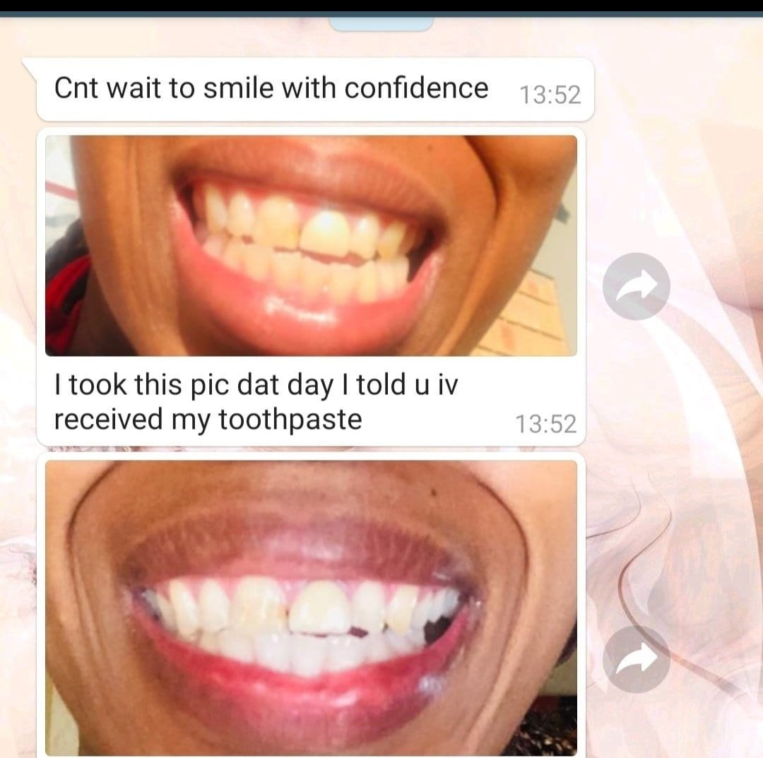 Lush_Beauty1's tweet photo. Yellow stained teeth a problem? Smoker or wine drinker AP24 Whitening Fluoride Toothpaste can help to :

● Brightens &amp; Whitenes
● Fight Plague 
● No Harmful to peroxide's 
● Remove stains &amp; Prevent cavities

Whatsapp 0749777590 
#SmileWithDima https://t.co/YqSpyoGmlP