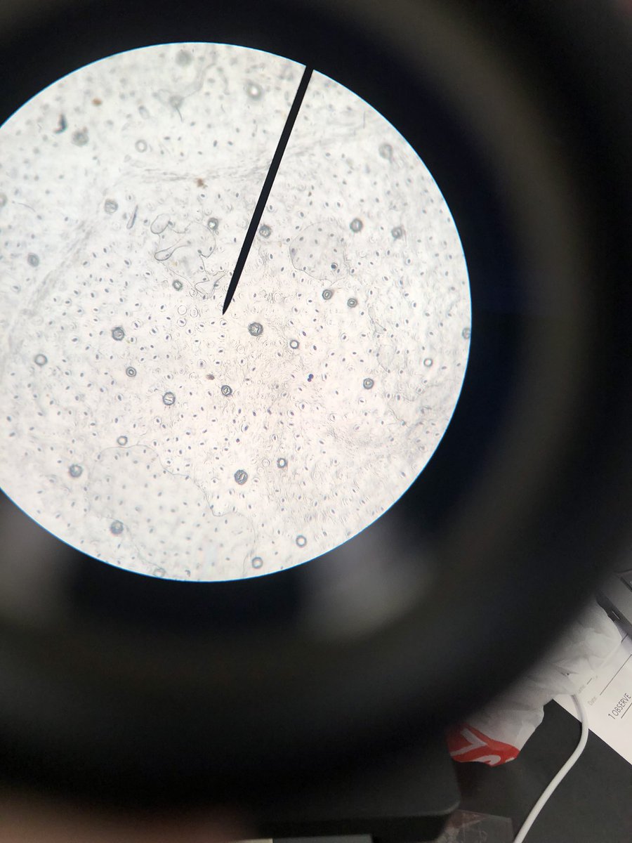 STMsrichards's tweet image. Did u know that plants have microscope openings@called stomata on their leaves for gas exchange?? They do!!  Even grass does !!!Take a look!!!  #stomata #microscopelab #handsonlearning #ilovebiology #curiosityisagoodthing