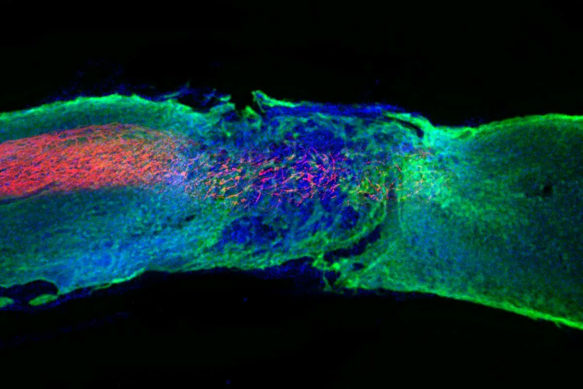 vurtomatic's tweet photo. Spinal cord injury: Gel treatment allows paralysed mice to walk again | New Scientist https://t.co/SJhPse2rWs https://t.co/utcG8S6dJH