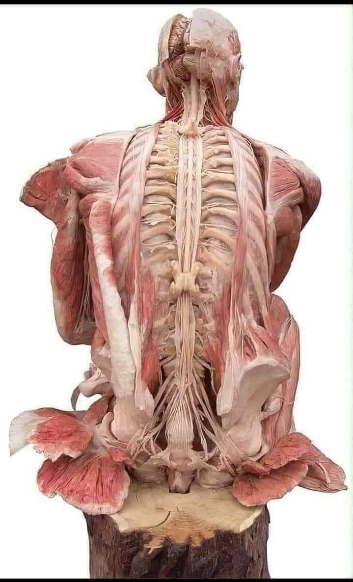 Neurosurgery Cocktail (@bipinchaurasia_) on Twitter photo 