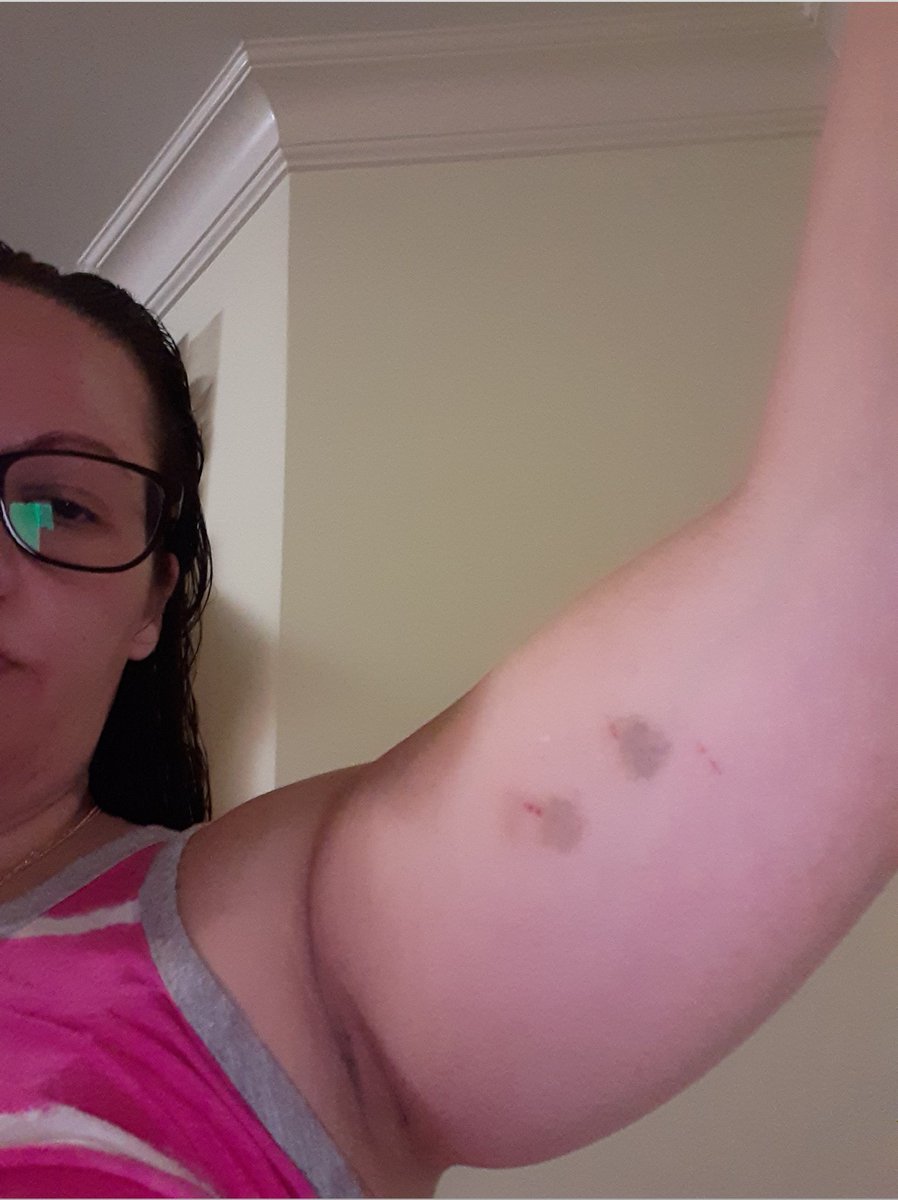 Isabel Dias tweet media