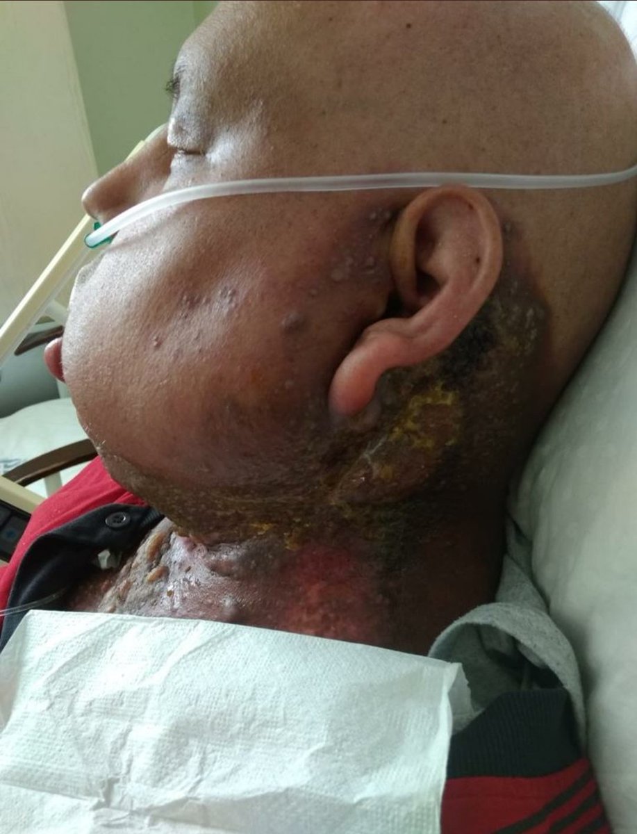JournalistYaman's tweet photo. Adı İhsan Yıldız. İlkokul öğretmeniydi. 4. evre kanser hastası olmasına rağmen hapse attılar, zulmettiler. Vefat etti. Nasıl bir alçaklıktır!
Yine 4. evre kanser hastası olan Ayşe Özdoğan'ın da ölmesini bekliyorlar. O da hâla hapiste. Halsiz, bitkin, ölmeyi bekler hale gelmiş. https://t.co/TDBayvNthd