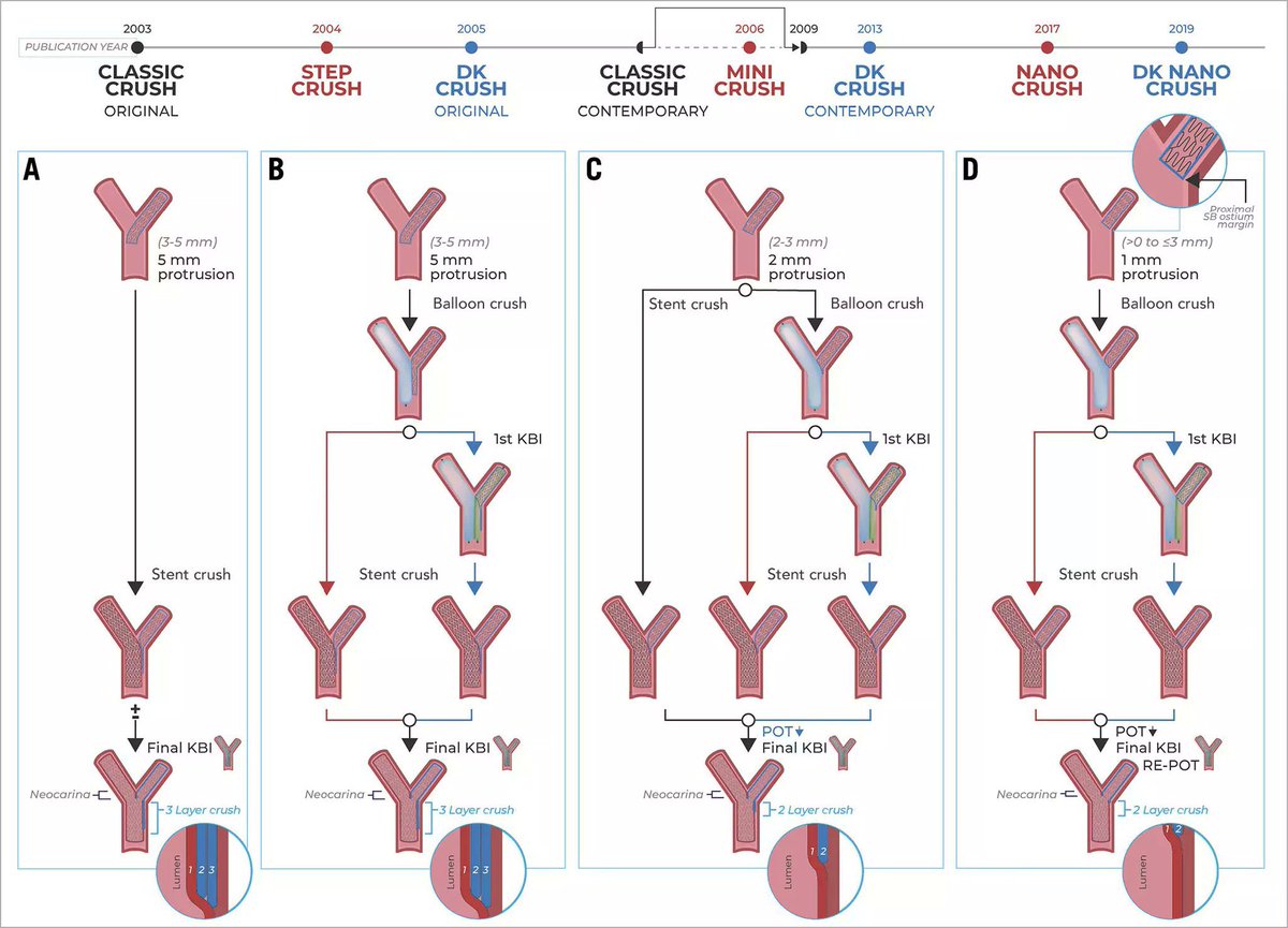 HolgerNef's tweet photo. Evolution of Bifurcation #pci…excellent review by Moroni et al. But has the evolution already arrived in every cathlab??? #education #agik #bestoutcomeforpatients #fightcad @MarcVorpahl @kaschenke @KardiologieHH #forbetterpci https://t.co/mb1M2Ehs2q