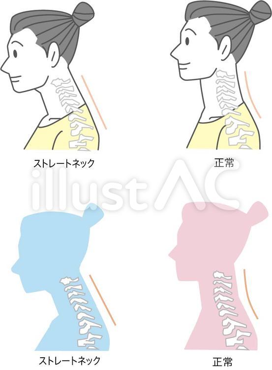 Uzivatel イラスト素材提供販売中 By Kana129 Na Twitteru 人気のイラストプレビュー 人気のあった過去作です フリー素材です T Co Nx0stk2cfe イラストac ストレートネック改善 姿勢改善 スマホ首 整体 美容 肩こり改善 T Co