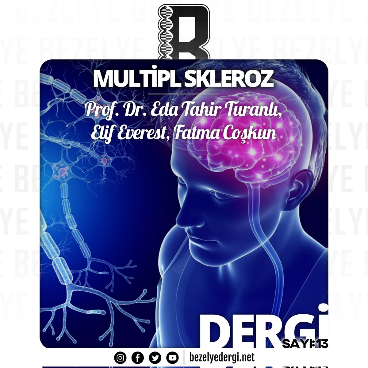 BezelyeDergi's tweet photo. “Multipl skleroz (MS), belirtilerinde ve seyrinde kişiden kişiye farklılık gösteren, merkezi sinir sisteminin bağışıklık sistemi aracılı nörolojik bir hastalığıdır…”
➡️https://t.co/7MougPMKrP
#multiplskleroz #MS #miyelin #KBB #proteom #patofizyoloji #sinirsistemi #sinirbilim https://t.co/4PF6Jr8KD8