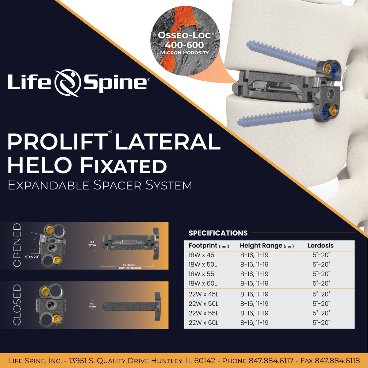 Life_Spine's tweet photo. ProLift Lateral HELO Fixated with Osseo-Loc® Surface Technology offers a micro invasive solution for Lateral Lumbar Interbody fusion.

Learn more about ProLift Lateral HELO Fixated and the benefits it can provide at: https://t.co/uaMpNozGUa

#lifespine #spinehealth #spineexperts https://t.co/H0tJ3hrCzF