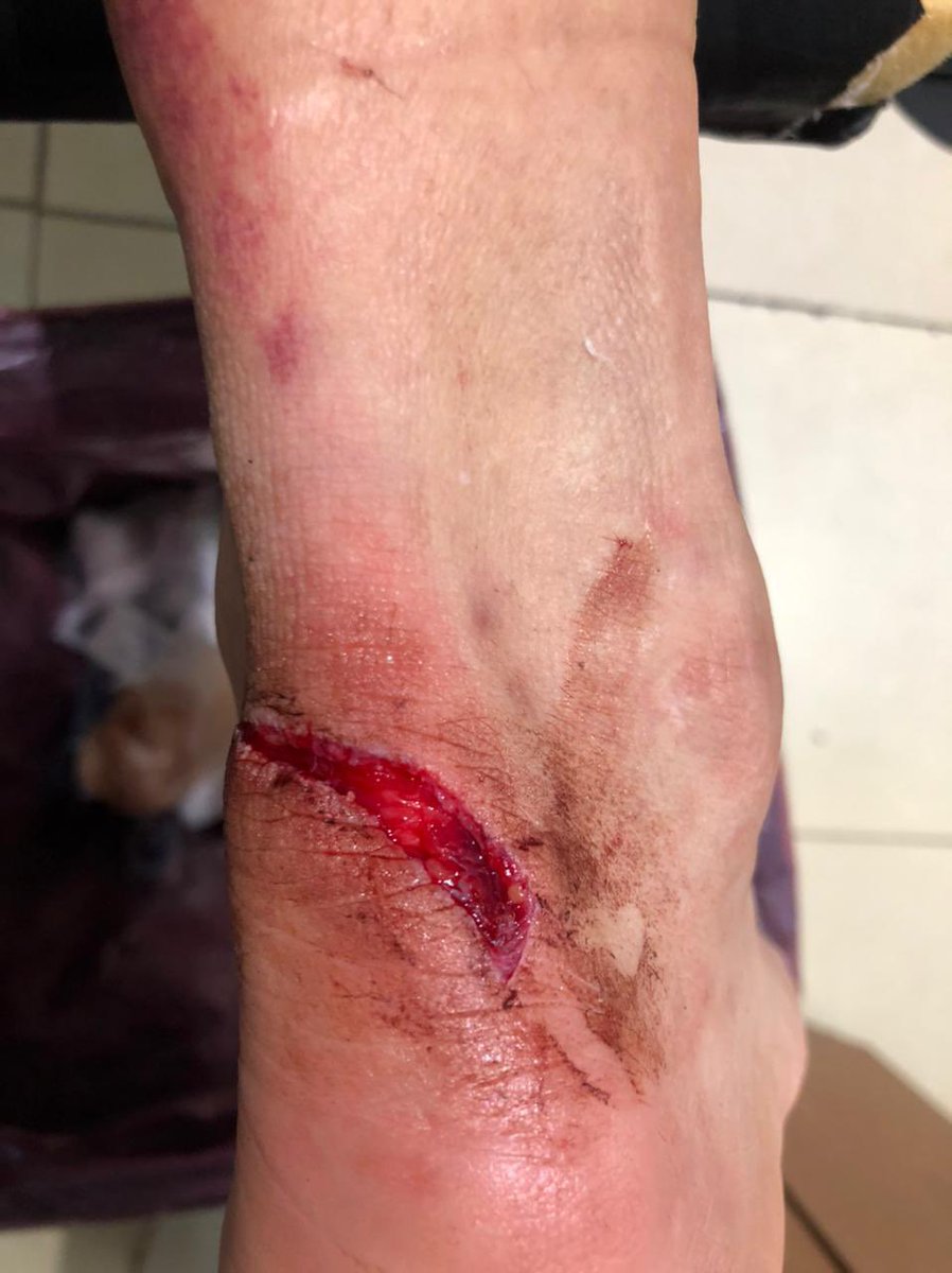 matiasgimenezLM's tweet photo. Esto me dejo el partido de ayer. #primeraC https://t.co/Zg7L0H9AKi