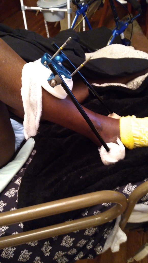 You never know how much you have to be thankful for until you have limitations