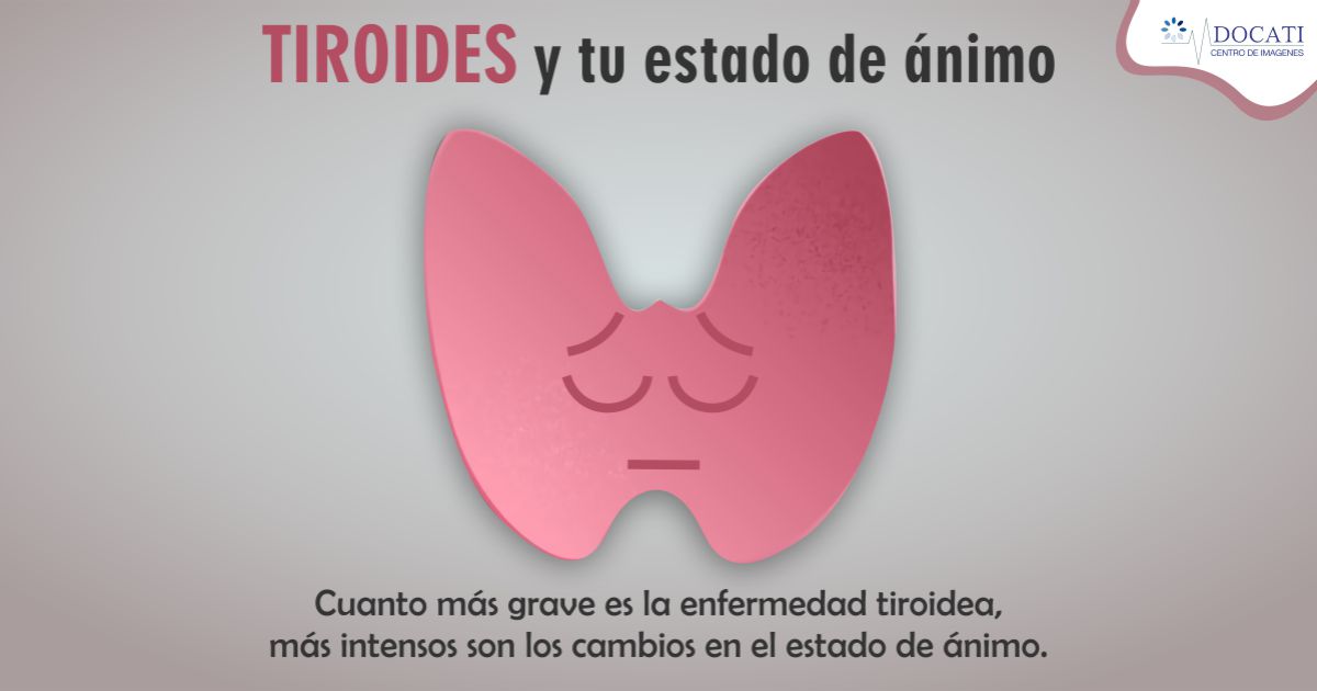ClinicaDocati1's tweet photo. 📌La enfermedad tiroidea puede afectar tu estado de ánimo y causar ansiedad o 😟depresión. En general, cuanto más grave es la enfermedad tiroidea, más intensos son los cambios en el estado de ánimo. 😵
#InfoDocati #panamacity #cintarosada #DocatiPanama #MamografiaPanama https://t.co/1YC1Ro3pv3