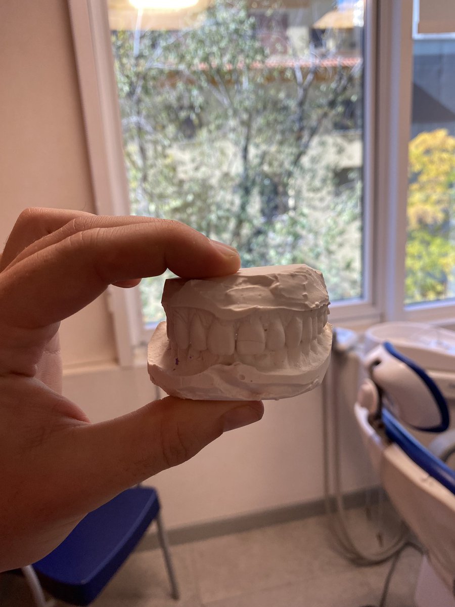 MKDLuffy1945's tweet photo. Fin de semana intenso: empezando el Máster en Implantología en Madrid trabajando atope. Planificación quirúrgica y toma de modelos. Mañana debut en #LigaLAPI con nervios pero muchas ganas. #VamosConTodo https://t.co/QTeCxLFBUj