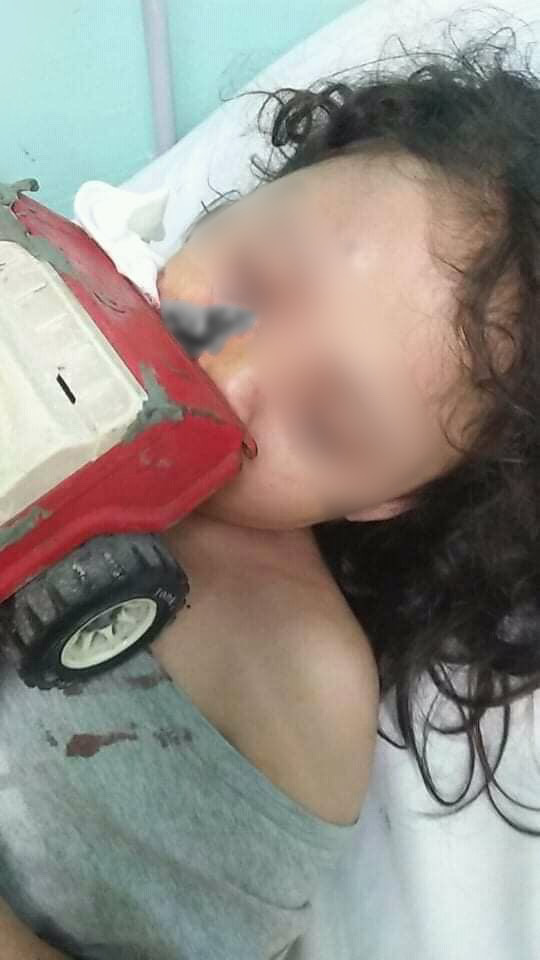 KM_Jessica_Soho's tweet photo. KOTSE-KOTSEHAN, BUMAON SA MUKHA NG ISANG BATA! PAANO NANGYARI ITO?

Paano rin natin masisigurong ligtas ang mga ireregalo nating laruan sa mga bata ngayong magpa-Pasko? #KMJS https://t.co/XmL3ulCrZq