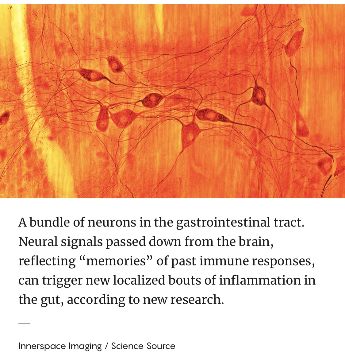 jmse7en's tweet photo. Very Interesting read- It “establishes that the classic concept of immunological memory can be represented in neurons.” New provocative Neuroimmunological paper published: “The Brain Can Recall and Reawaken Past Immune Responses” #Immunology #neuro #brainmemory #cell #Technion https://t.co/ZRiXiKvNvh