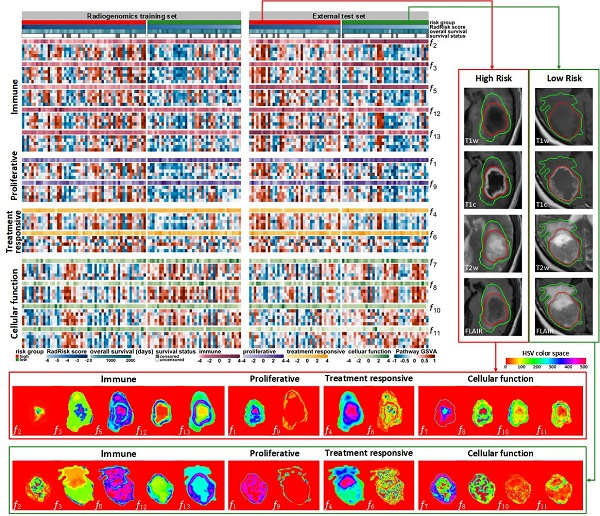 Biologic Pathways Underlying Prognostic Radiomics Phenotypes from Paired MRI and RNA Sequencing in Glioblastoma
pubs.rsna.org/doi/abs/10.114… via Radiology~

I'm bullish on imaging genomics and radiogenomics.