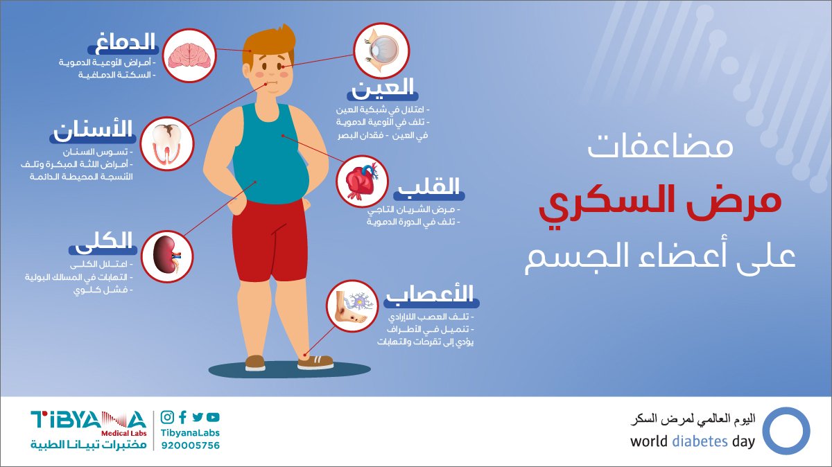 TibyanaLabs's tweet photo. مضاعفات مرض السكري على أعضاء الجسم 🍪

اليوم العالمي لمرض السكر 🔵
"14 نوفمبر "

#اليوم_العالمي_للسكري
#مختبرات_تبيانا #تبيّن_تطمّن #tibyanalabs https://t.co/75OncB2eZW