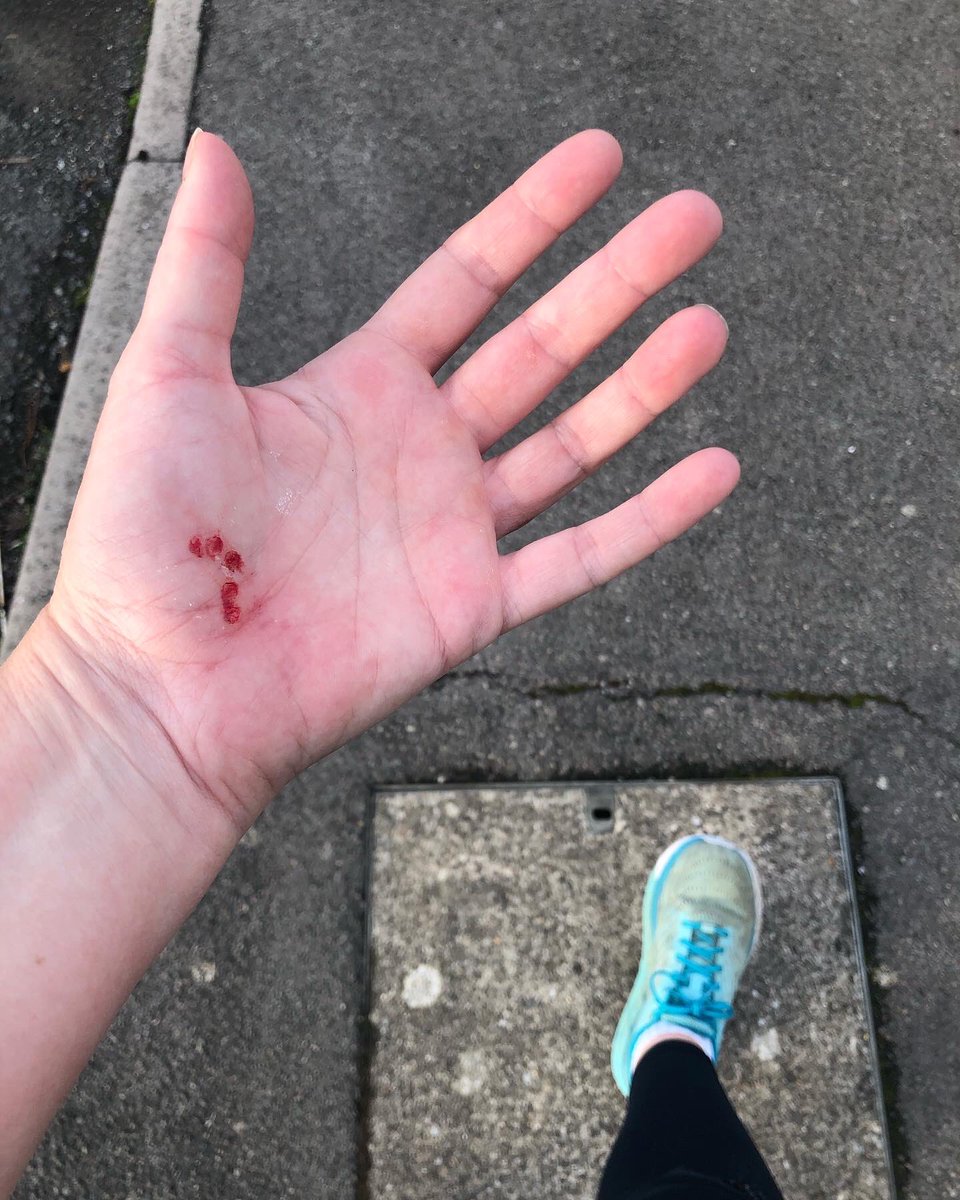 littleboris's tweet image. What happens when you haven’t run for months &amp;amp; start enjoying it too much?? #feelstupid #ouch #thathurt #walkinghome #runningisntforme