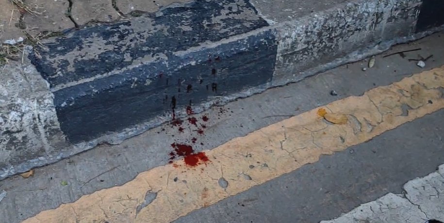 tigeryellowlive's tweet image. เกิดความชุลมุนมีชายคนหนึ่งโดนยิงที่ท้อง บรเวณหน้าสถาบันนิติเวช นำส่งโรงพยาบาลแล้ว ผู้ถูกยิงมีสติดี #ม็อบ14พฤศจิกายน