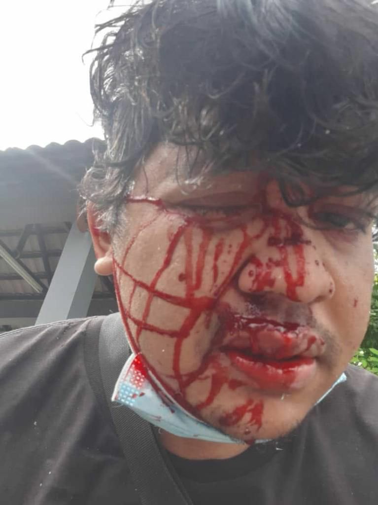 HafizRayyan's tweet photo. Wahyu, makhluk Allah yg dikurniakan kekuatan yg hebat. Moha cepat sihat.

Doakan sahabat sekolah saya lekas sembuh. Kemalangan sebentar tadi. https://t.co/cUoOvD81pV