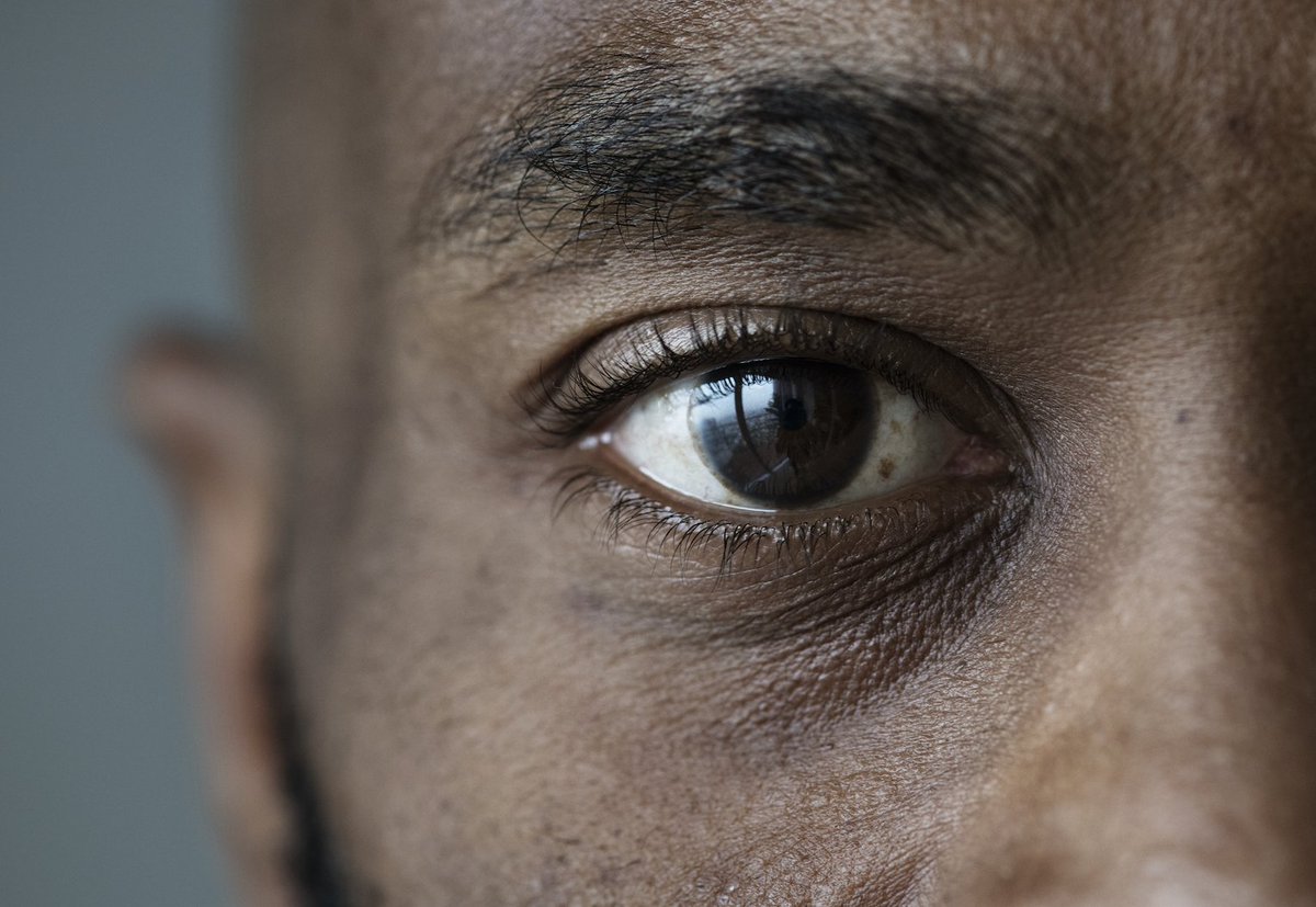 CollegeOptomUK's tweet photo. Did you know more than 4.9 million people in the UK are currently living with diabetes? This #WorldDiabetesDay we look at the complications undiagnosed diabetes can cause, and the role of optometrist in detecting and preventing this condition. Read now ➡️ https://t.co/oLDJwkOz5f https://t.co/rLQKrit1nk