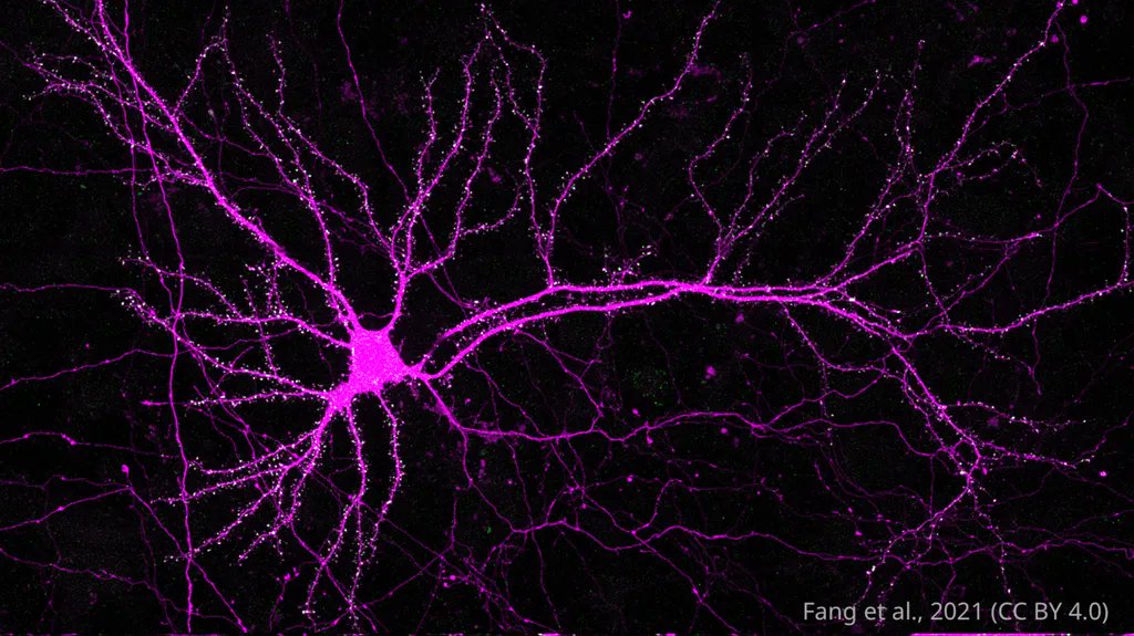 eLife's tweet photo. Researchers have developed an optimised CRISPR/Cas9 approach for precise genome editing in neurons https://t.co/rrt8ll2Gwy https://t.co/UM61E1JaLH