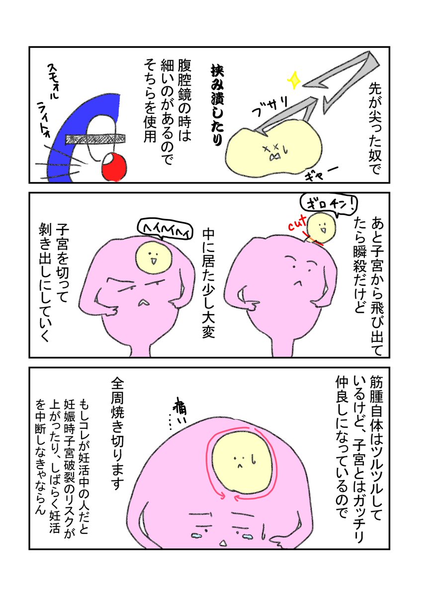 筋腫合併妊娠のエピローグ+筋腫核出術について
久しぶりに長いの描いたら首が痛い…🤤
とりあえず推しの子見て週を締めくくります
#漫画が読めるハッシュタグ  #エッセイ漫画 