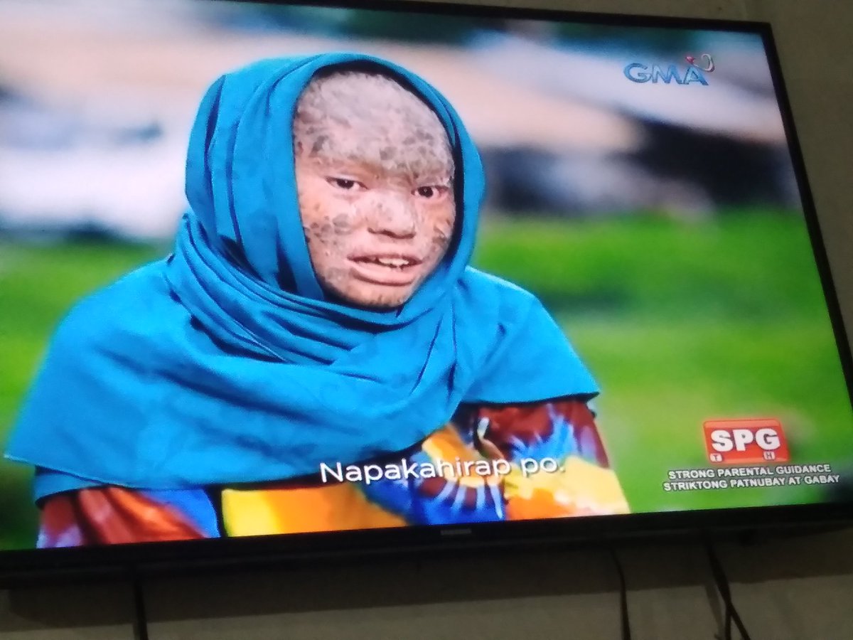 IamLjAli's tweet photo. Kawawa naman yung bata. When you think your life is bad pero you failed to realize some people have it worst.

#KMJS https://t.co/czpUd6zEbH