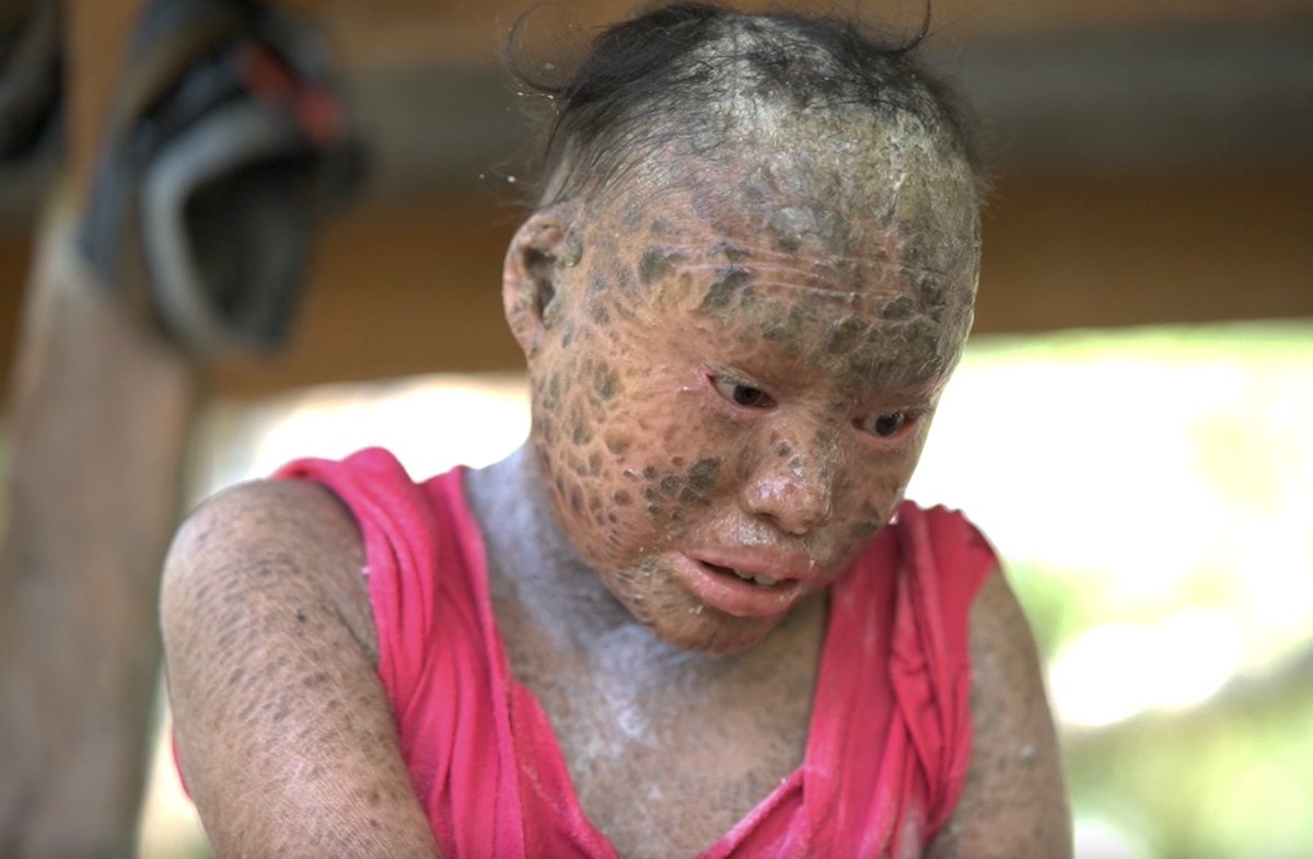Para sa mga nais tumulong kay Analiah, maaaring magdeposito sa:
LANDBANK-KAPATAGAN, LANAO DEL NORTE BRANCH
ACCOUNT NAME: BOCARI D. SARIP
ACCOUNT NUMBER: 4236-0363-11

#KMJS