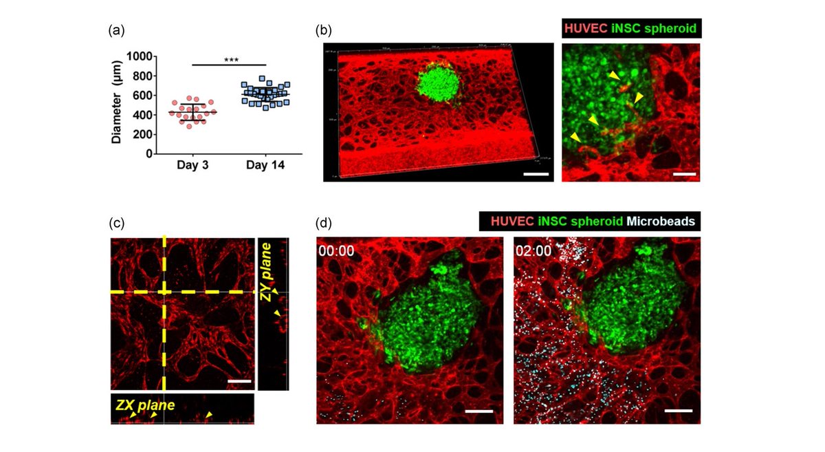 organoidscience's tweet photo. Scientists created a 3D model of vascularized spheroid 🔵 cells using an injection-molded microfluidic chip, and cocultured spheroids derived from induced #NeuralStemCells with perfusable blood 🩸 vessels.
https://t.co/cJpoeYKPYs https://t.co/vWDmeqjnqQ
