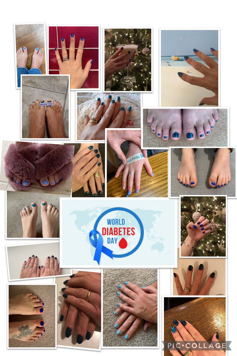 #WorldDiabetesDay #UHD #nailingdiabetes <a href="/DiabetesUK/">Diabetes UK</a> RBH diabetes team standing together with people with diabetes and offering our hands of support