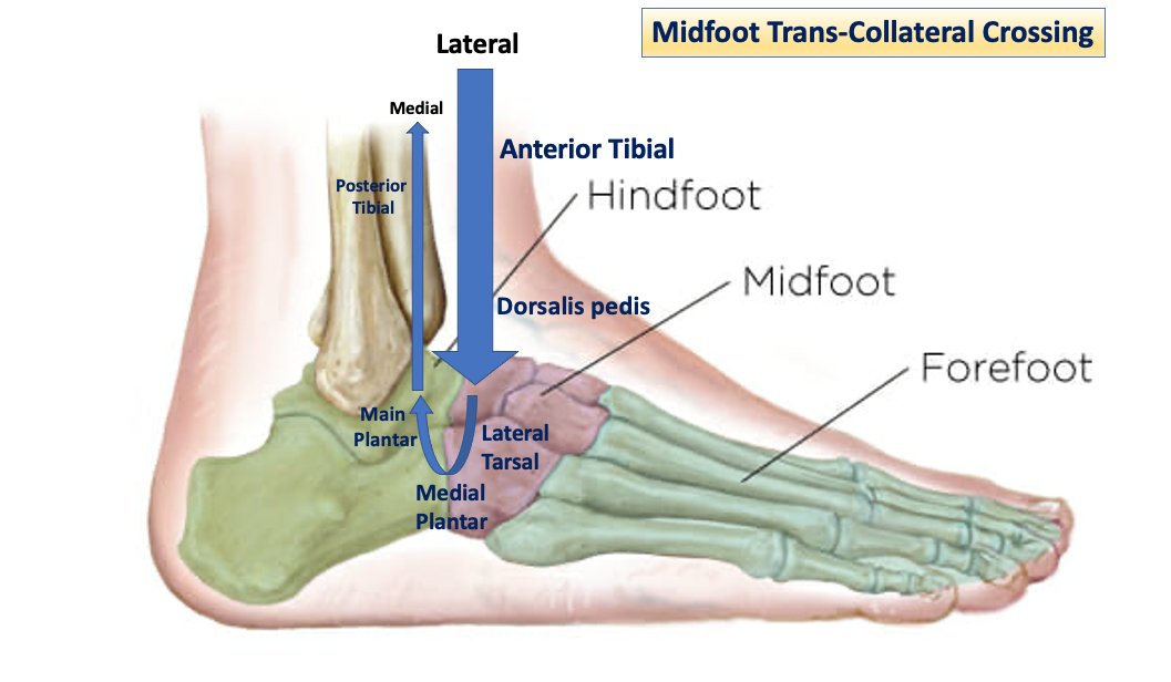 HadyLichaaMD's tweet photo. #PERIPHERAL series Ep. 2: #MidFoot vs #Forefoot #Transcollateral #wire #crossing
https://t.co/JHSmn7Mgbn
@SCAI @DrAmirKaki @EricSecemskyMD @herbaronowMD @mirvatalasnag @SanChris999 @Pooh_Velagapudi @RajTayalMD @kerrigjl @dandu_n @SripalBangalore @LorenzoPatrone3 @YsaAugust https://t.co/6Cor5cWJUt