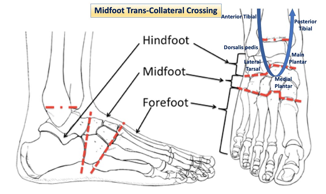 HadyLichaaMD's tweet photo. #PERIPHERAL series Ep. 2: #MidFoot vs #Forefoot #Transcollateral #wire #crossing
https://t.co/JHSmn7Mgbn
@SCAI @DrAmirKaki @EricSecemskyMD @herbaronowMD @mirvatalasnag @SanChris999 @Pooh_Velagapudi @RajTayalMD @kerrigjl @dandu_n @SripalBangalore @LorenzoPatrone3 @YsaAugust https://t.co/6Cor5cWJUt