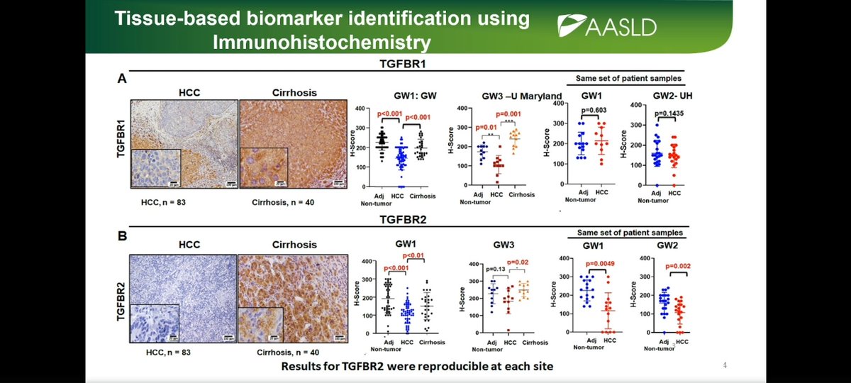 Interesting talk by Shuyun Rao. TGF-beta proteins may serve as accurate biomarkers in early detection of #HCC #LiverCancerSIG #LiverMTG2021 @docamitgs @nicole_rich8 @AndrewMMoon