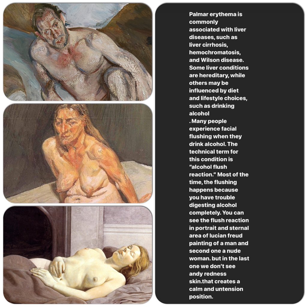 farsamartist's tweet photo. Part 2
Erythema and blushing effects in figures painted by Lucian freud , Egon Schiele and other great masters.
Author : Farsam Sangini
#anatomyforartists #anatomypractice #anatomytips https://t.co/kVMgxqKZ5w