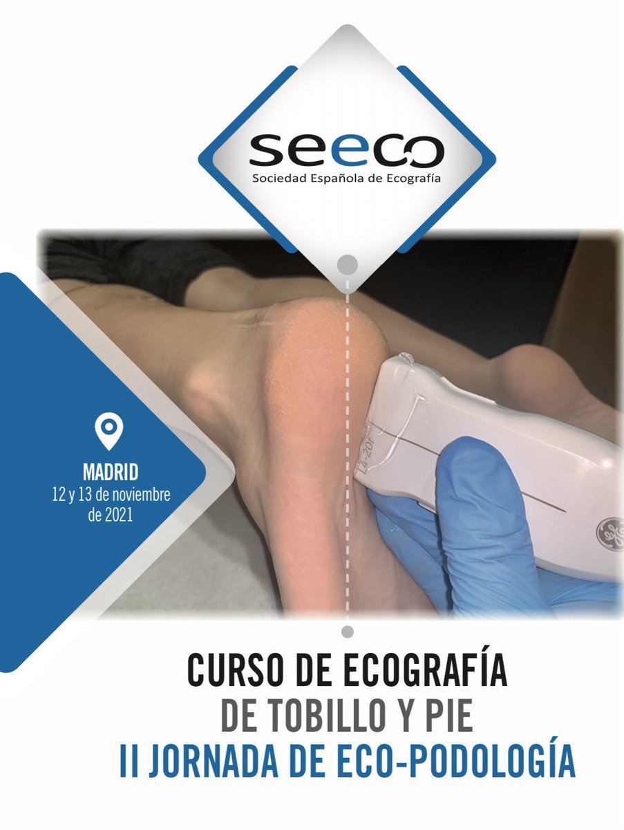 SanJoseClinica's tweet photo. SEECO (Sociedad Española de Ecografía).
Clausura del Curso de Ecografía de Tobillo y Pie, con una gran organización, instalaciones y compañeros ponentes Dr. cerezo, Dr. Jimenez @fjdconesa D. Samuel Pina @podosamuel D. Emilio Merchan https://t.co/pb9DNexcOU