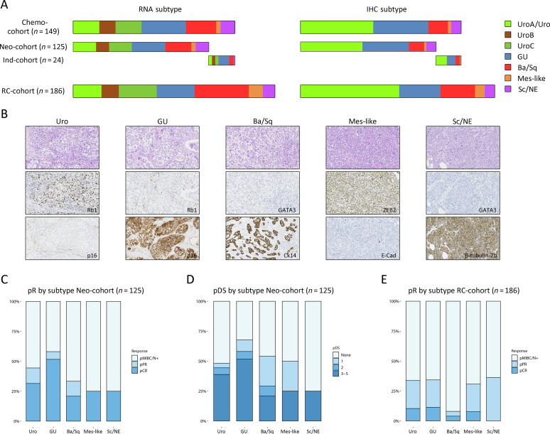 EUplatinum's tweet photo. Different Responses to Neoadjuvant Chemotherapy in Urothelial Carcinoma Molecular Subtypes

https://t.co/l6dPPAtkb7

@GottfridSjodahl @UroLiedberg 

"Urothelial cancer of the luminal-like subtypes is more responsive to cisplatin-based neoadjuvant chemotherapy" https://t.co/bql0DcLAds