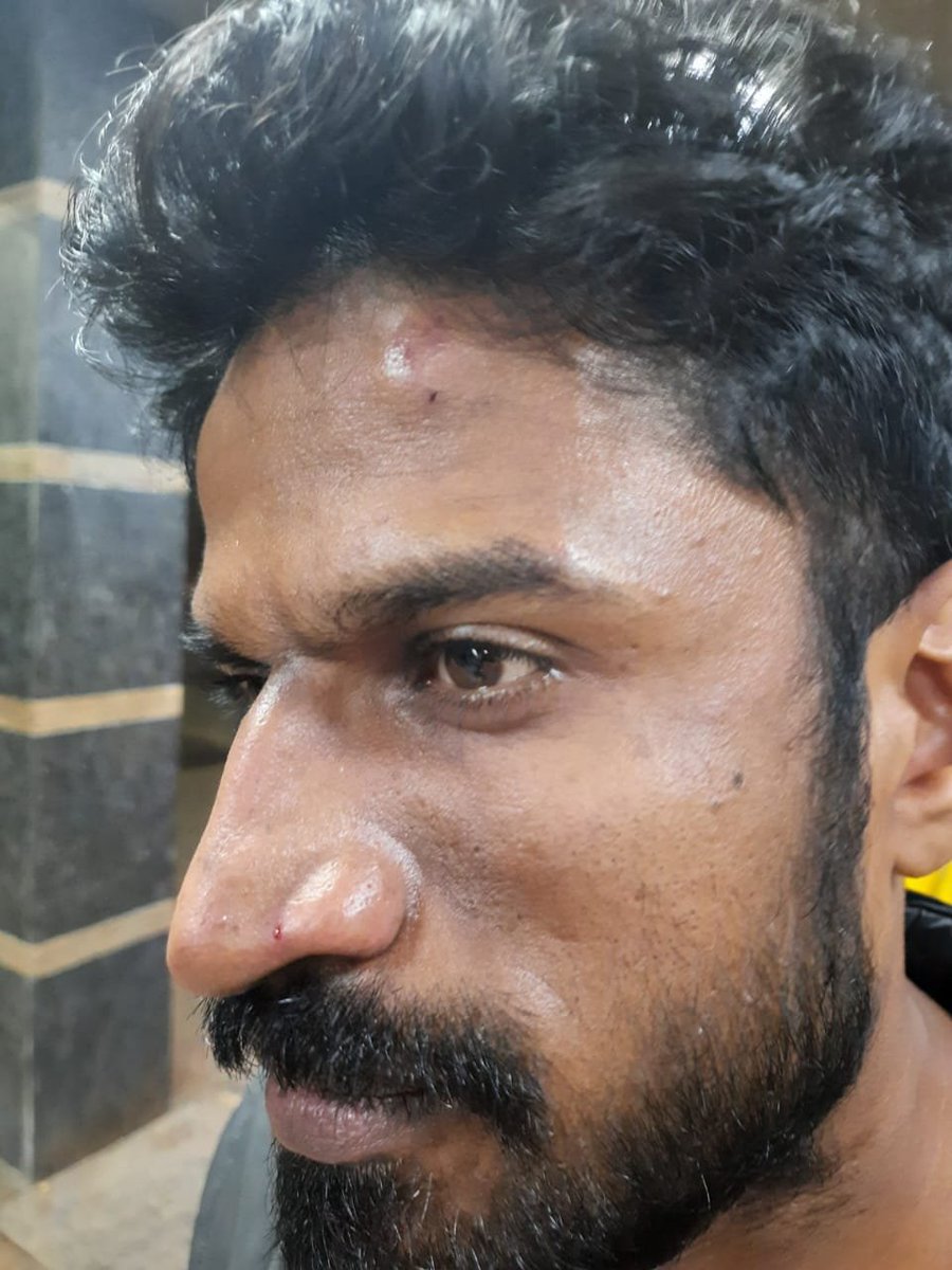 aishe_ghosh's tweet photo. ABVP'S GOONS UNLEASHED VIOLENCE IN JNU TODAY.

Time and again these criminals have  unleashed violence on students and have disrupted campus democracy.

Will the JNU Administration still be silent ? Will no actions be taken on the goons ?

Photos of students attacked today. https://t.co/ZnkjZ10Vhq