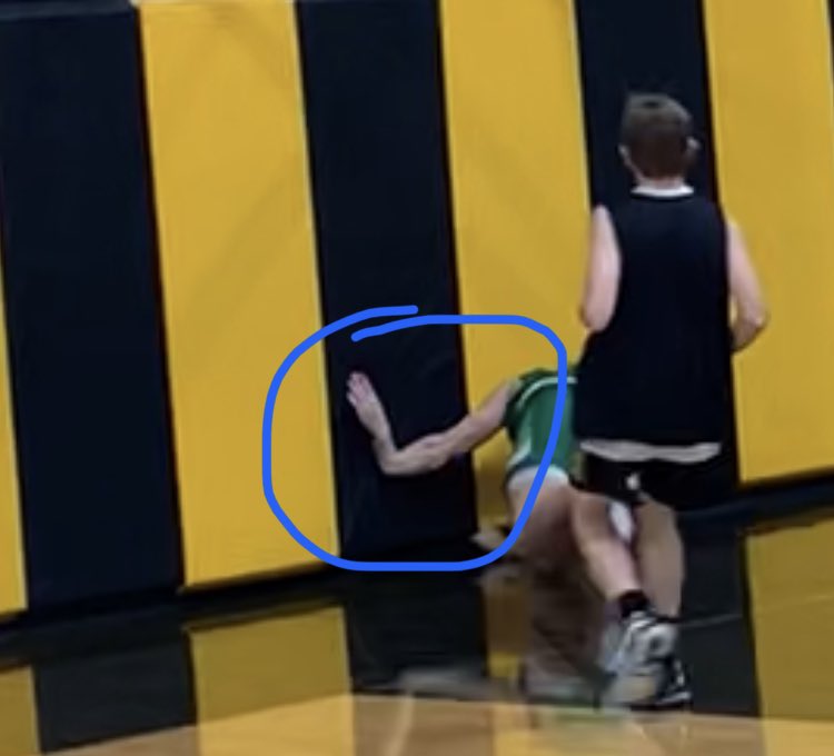 Everson_Arms's tweet photo. Very bitter return to play only 90 seconds into my first scrimmage. Prayers go up for everyone this season to remain injury free because I would never wish this on anyone https://t.co/L82o2OIPcL