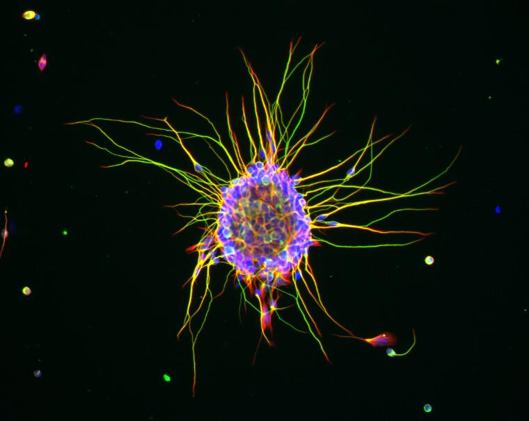 TheScientificF2's tweet photo. This Week's #ImageoftheWeek is Neuron in culture, exciting isn't it?
Know more about our #ImageoftheWeek at https://t.co/OWMU2m5XyL
#thescientificfactor #sciencelove #brain #neuroscience #neurons #cells #cellculture #studenti #cellculturelab #cellbiology #molecularbiology https://t.co/62xqLRYJxU