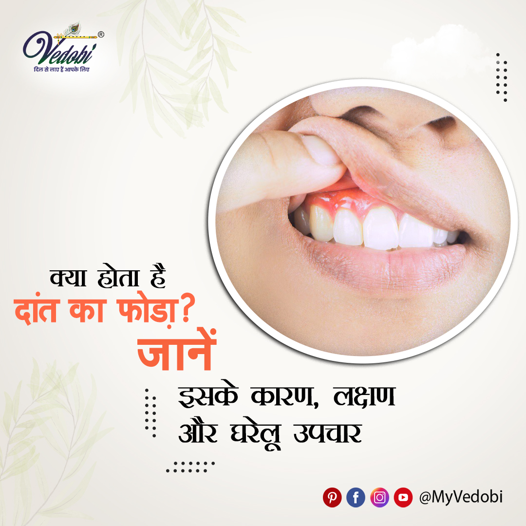 MVedobi's tweet photo. Click Here To Read More👇

https://t.co/AnpvlVqWu5
दांत में फोड़े के लक्षण-
दांत में जब फोड़ा होता है, तो दांत और मसूड़ों का दर्द धीरे-धीरे जबड़ा, कान और गर्दन तक पहुंच जाता है। जिससे दांत या मसूड़े में फोड़ा निकल जाता है। अत:उसमें तेज दर्द होता है। https://t.co/ayDai64C0J