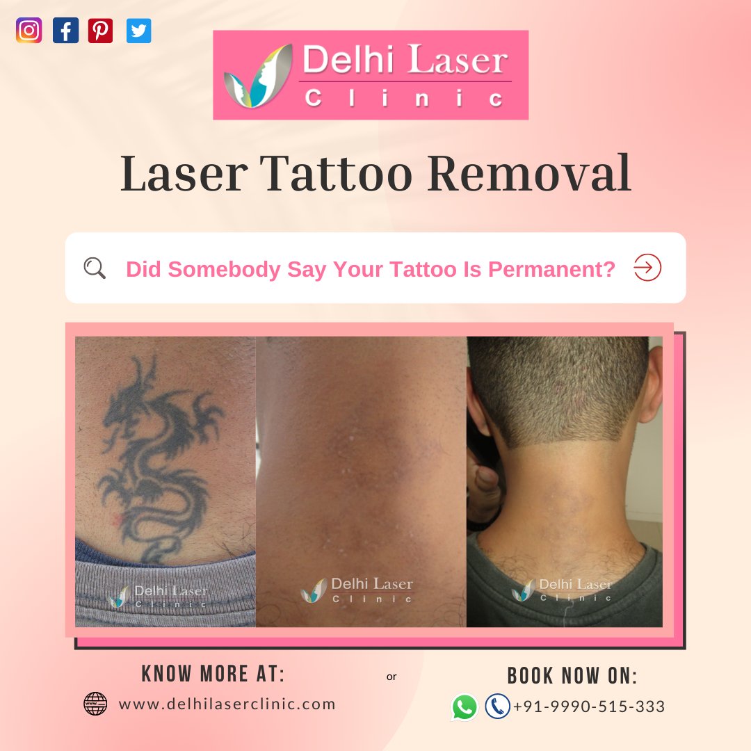 Delhi Laser Clinic on Twitter: 