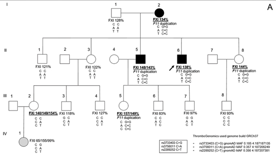 KathleenFreson's tweet photo. F11 gene duplication as risk for thrombosis. Case reports are important for gene-phenotype associations. @TH_Journal   https://t.co/hQzBXHMt5K https://t.co/HCasySZjA8