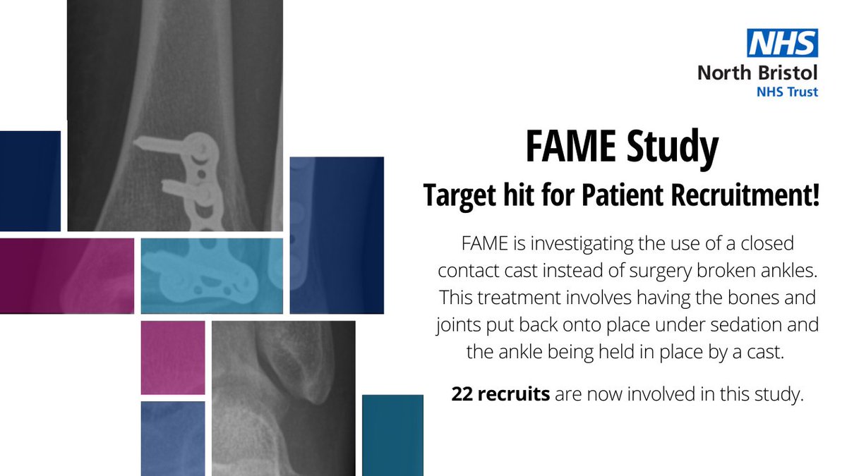 If you break your ankle and the joint isn’t stable, you would normally need surgery to have metalwork put in. FAME is looking at avoiding the risks associated with this by offering surgery-free treatment. Thank you to the 22 patients involved, and for helping our team hit target!