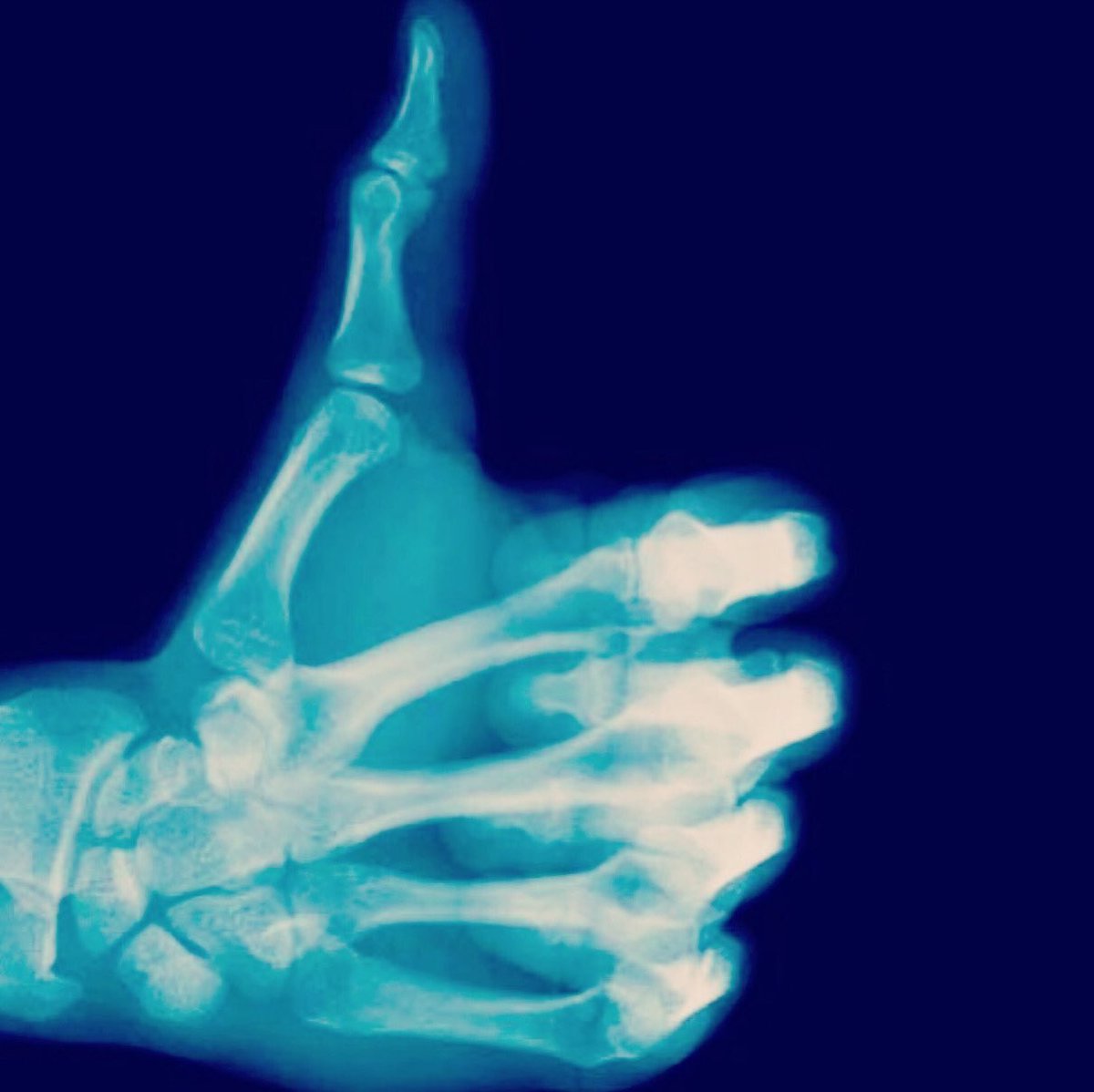 vcalderonosteo's tweet photo. "La osteopatía hará el trabajo si la aplicas correctamente". Andrew Taylor Still
#osteopathy #osteopath #ponunosteopataentuvida #osteópata #osteopatia #osteopatía #osteopatiaespaña #terapiacraneosacral #upledger #institutoupledger #violafrymann #andrewtaylorstill https://t.co/pCxwtBjUu0