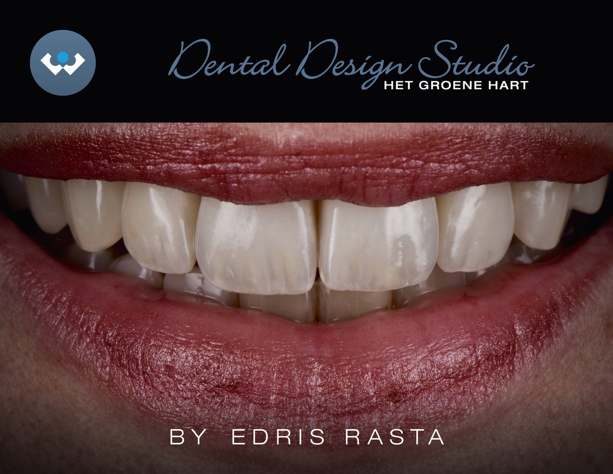 Excent Tandtechniek tweet media