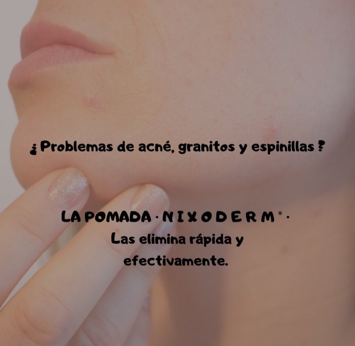 alexroserorrpp's tweet photo. TL les cuento que estoy vendiendo una súper crema para las espinillas, la mejor! 🔝 producto comprobado. 
Más información ⤵️ 
https://t.co/euiMT9kkb9 https://t.co/fx8TgqAZJm