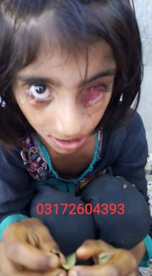 ZobiaKhurshid's tweet photo. آپ کا ایک #ریٹوئٹ سے اس معصوم کی جان بچا سکتی ہے

آنکھوں کے مرض میں مبتلا اس بچی کی علاج میں مدد کر دیں,

حکومت وقت فوری ایکشن لے بچی کا علاج کروانے میں مدد کرے.
 
03172604393 https://t.co/HAD25lWxhq