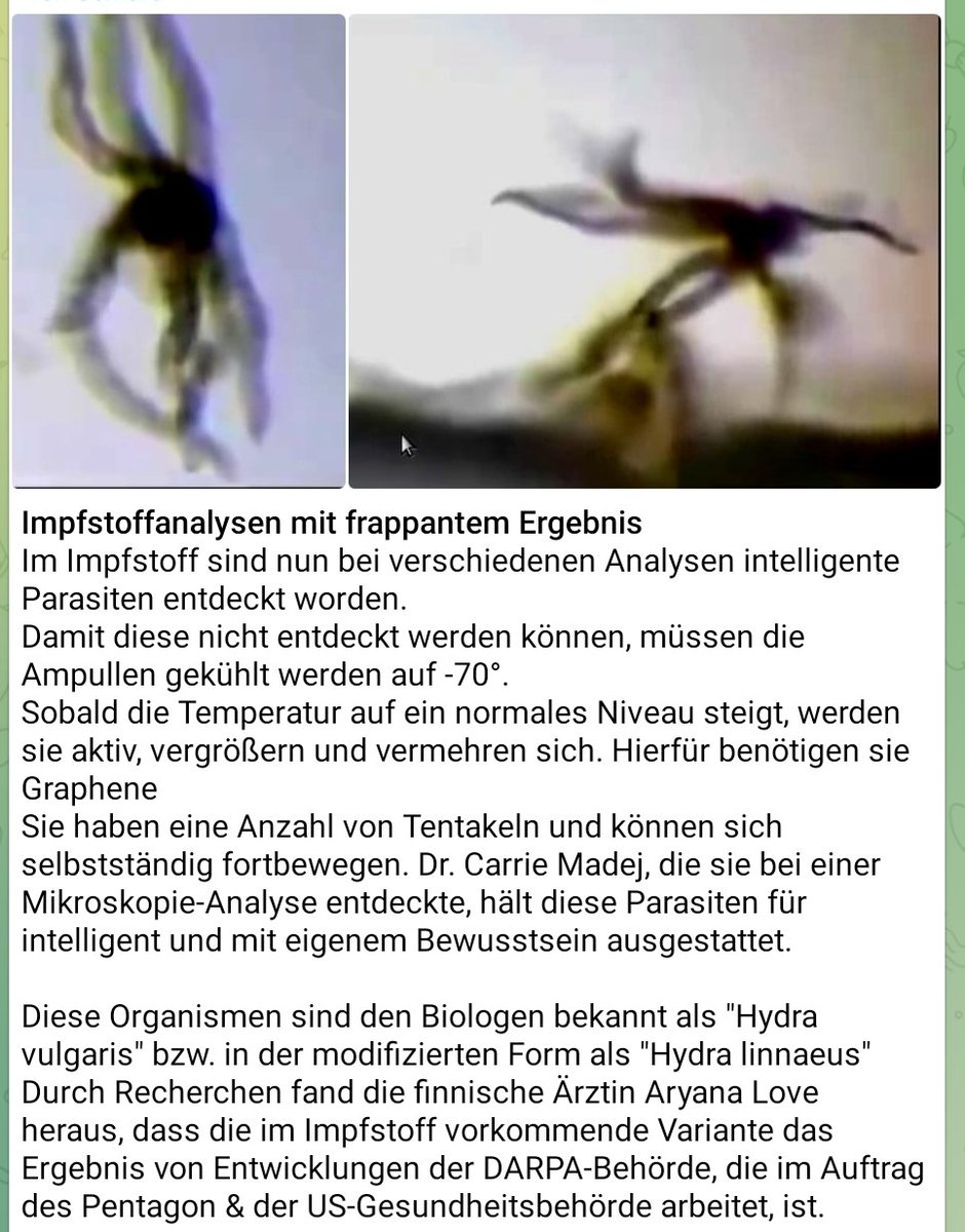 HaraldPohle's tweet image. Jetzt verstehe ich #impfverweigerer. Wer hat schon gerne plötzlich mehr Intelligenz im Arm als im Kopf? 🤣
#Deppen #Dullis